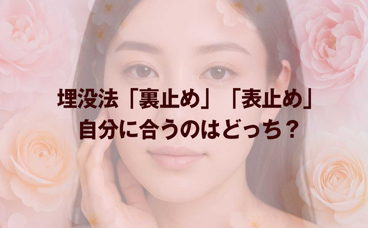 埋没法は裏止めと表止めのどっちがいい？後悔しない選び方をバレにくさ・持続力から解説